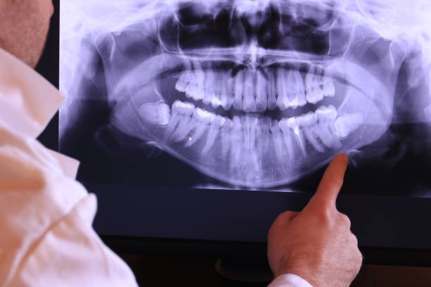 Urgent Tooth Repair in MN