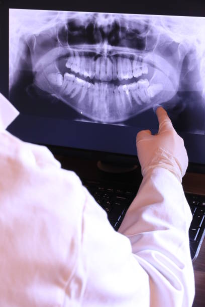 Best Chipped Tooth Repair Near Me  in New York Mills, MN